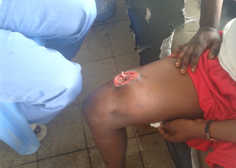 A young man receiving first aid at a medical centre in Kinshasa. He was shot by the police during the protest on 21 January 2018. He told Amnesty International that the police took him to the medical centre after taking all his money and cell phones