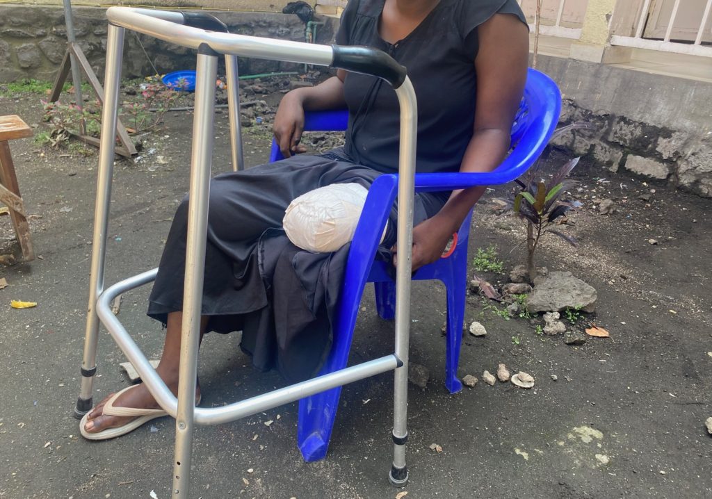 A woman in a dark dress sits in a blue plastic chair with a walker in front of her. She is missing her left leg above the knee, and the stump of her thigh is wrapped in a white bandage. She is wearing a flipflop sandal on her intact, right foot.