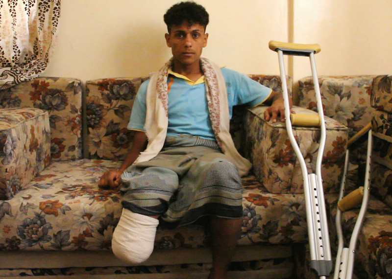 Bassel, 16 ans, a été blessé par une explosion secondaire après une frappe aérienne de la coalition sur un dépôt d'armes à Mount Nuqum, le 11 mai.
