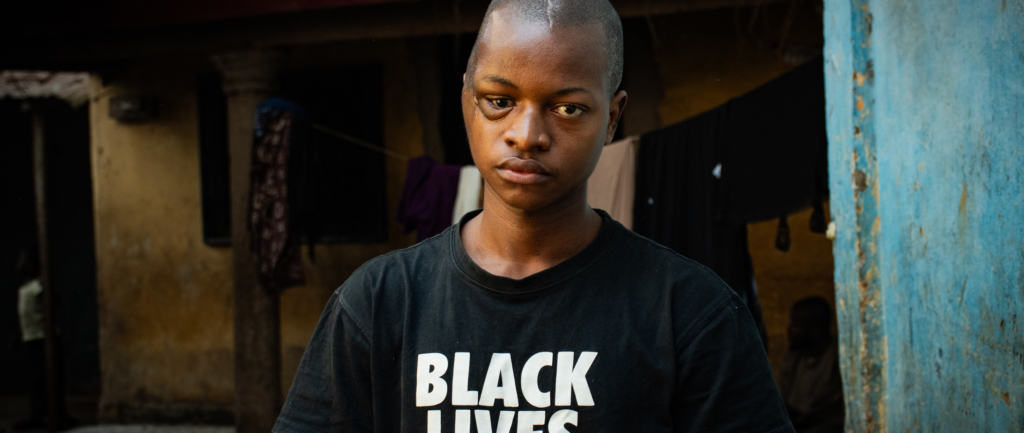 Boubacar Biro Sow a été blessé lors d'une manifestation par des personnes qu’il a identifiées comme des gendarmes en mai 2023 à Koloma, en Guinée